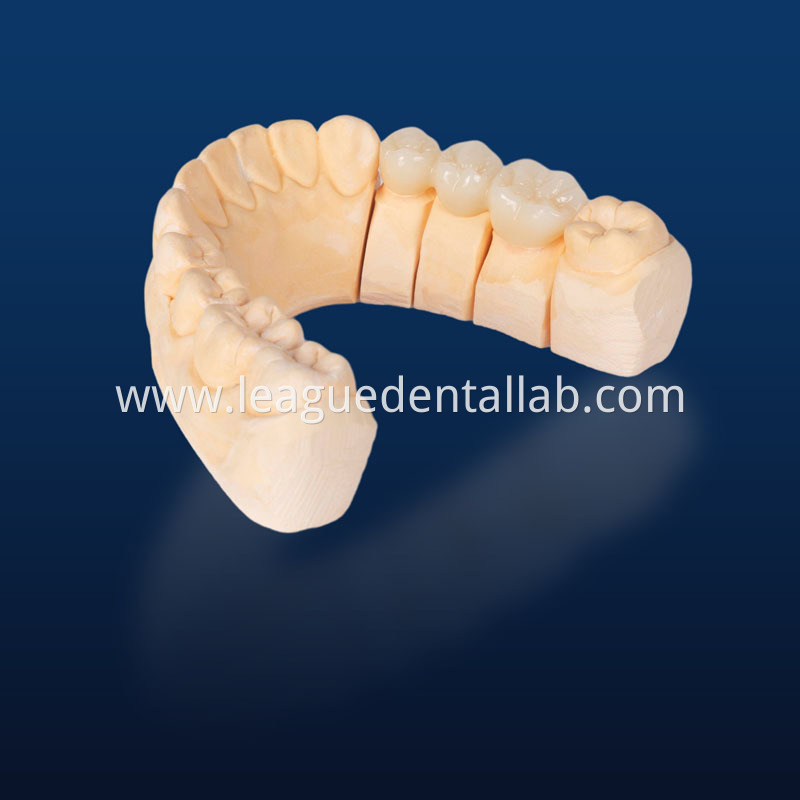 UTML zirconia,Katana zirconia,Esthetic zirconia,SHTML zirconia,3D Multilayered Zirconia